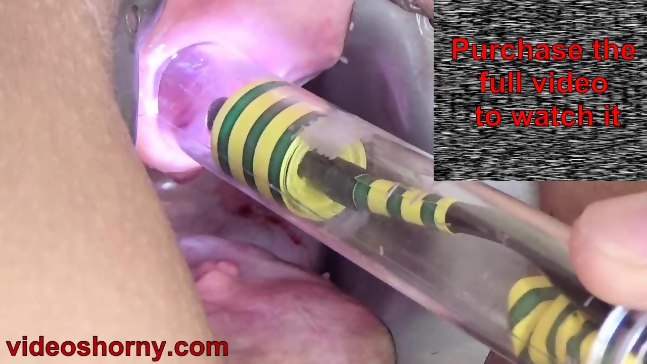 Girl Peehole Urethral Insertion with Endoscope Camera - EPORNER