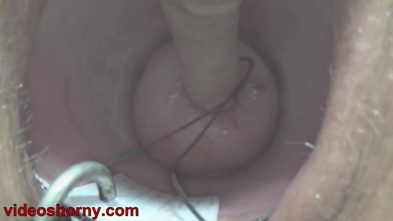 Uterus Penetration With Objects Pumping Cervix Prolapse EPORNER