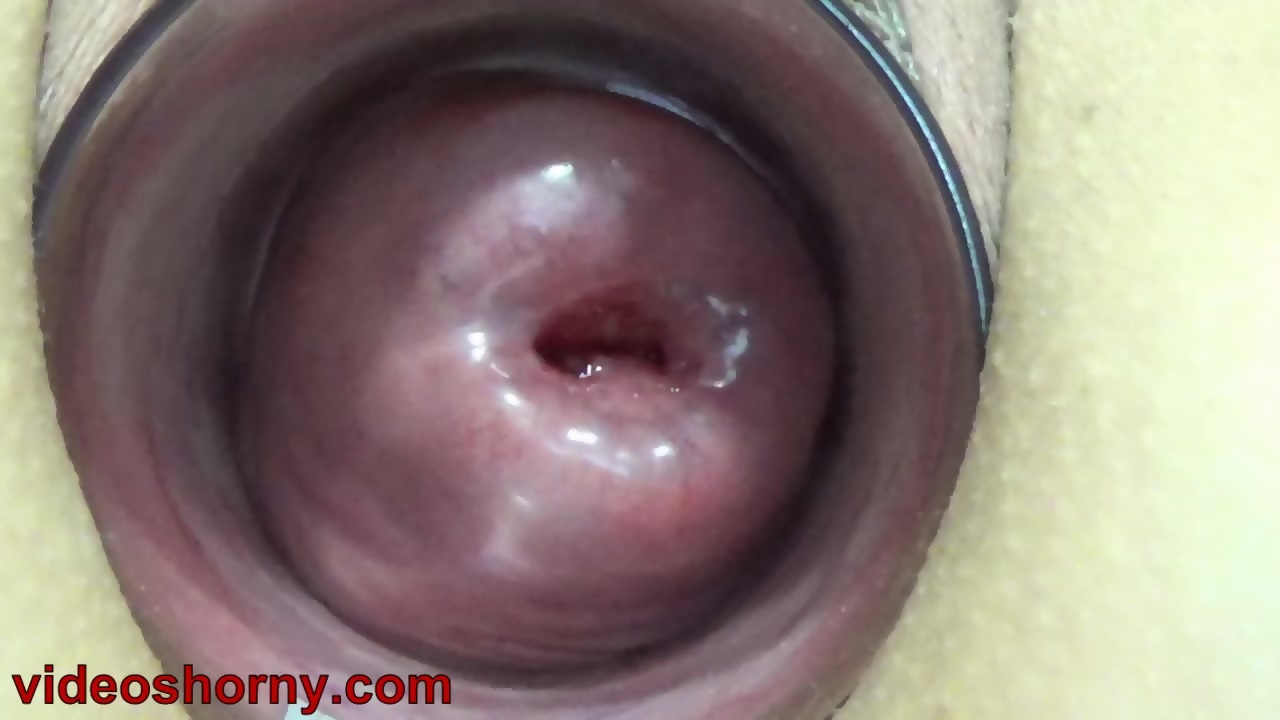 Extreme Cervix Insertion Pussy Hentai - Uterus Penetration with Objects, Pumping Cervix Prolapse