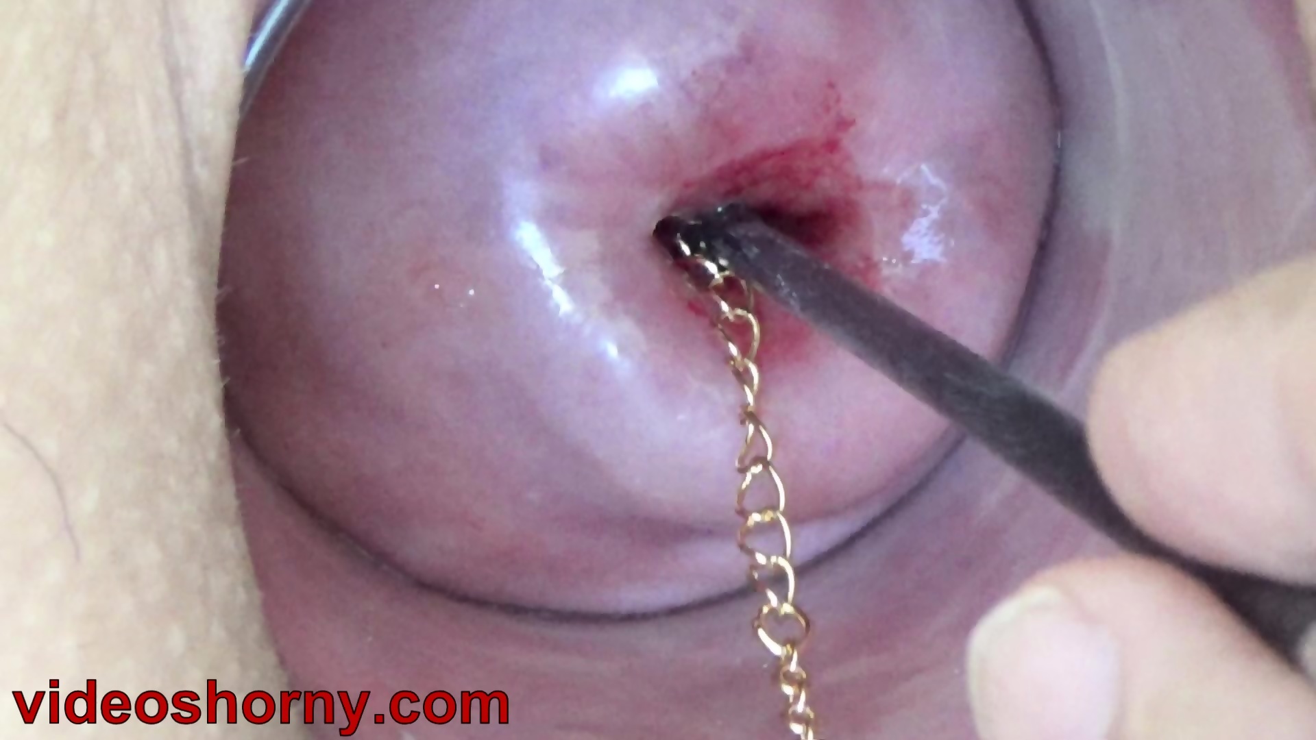 Extreme Cervix Play With Insertion Chain In Uterus Eporner 