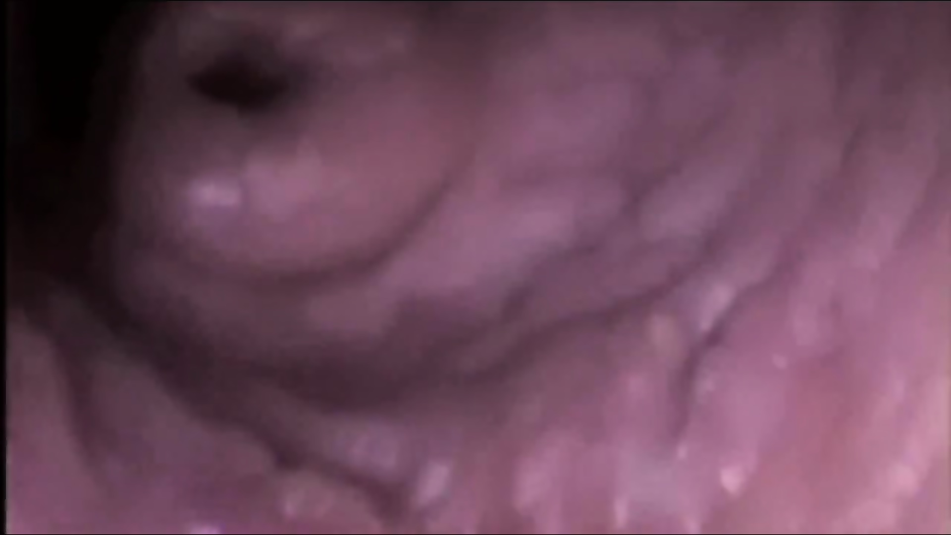 Cervix Kisses Cocks Cumming Inside Cumshot Compilation Eporner