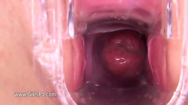 Gyno Toy Inside Of Her Fine Vagina Eporner