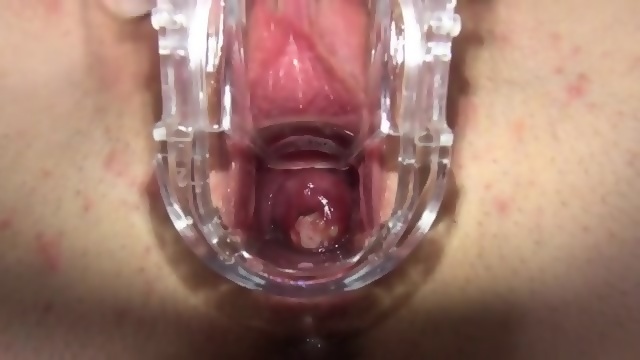 Gyno Vibrator Inside Of Her Beautiful Vagina Eporner