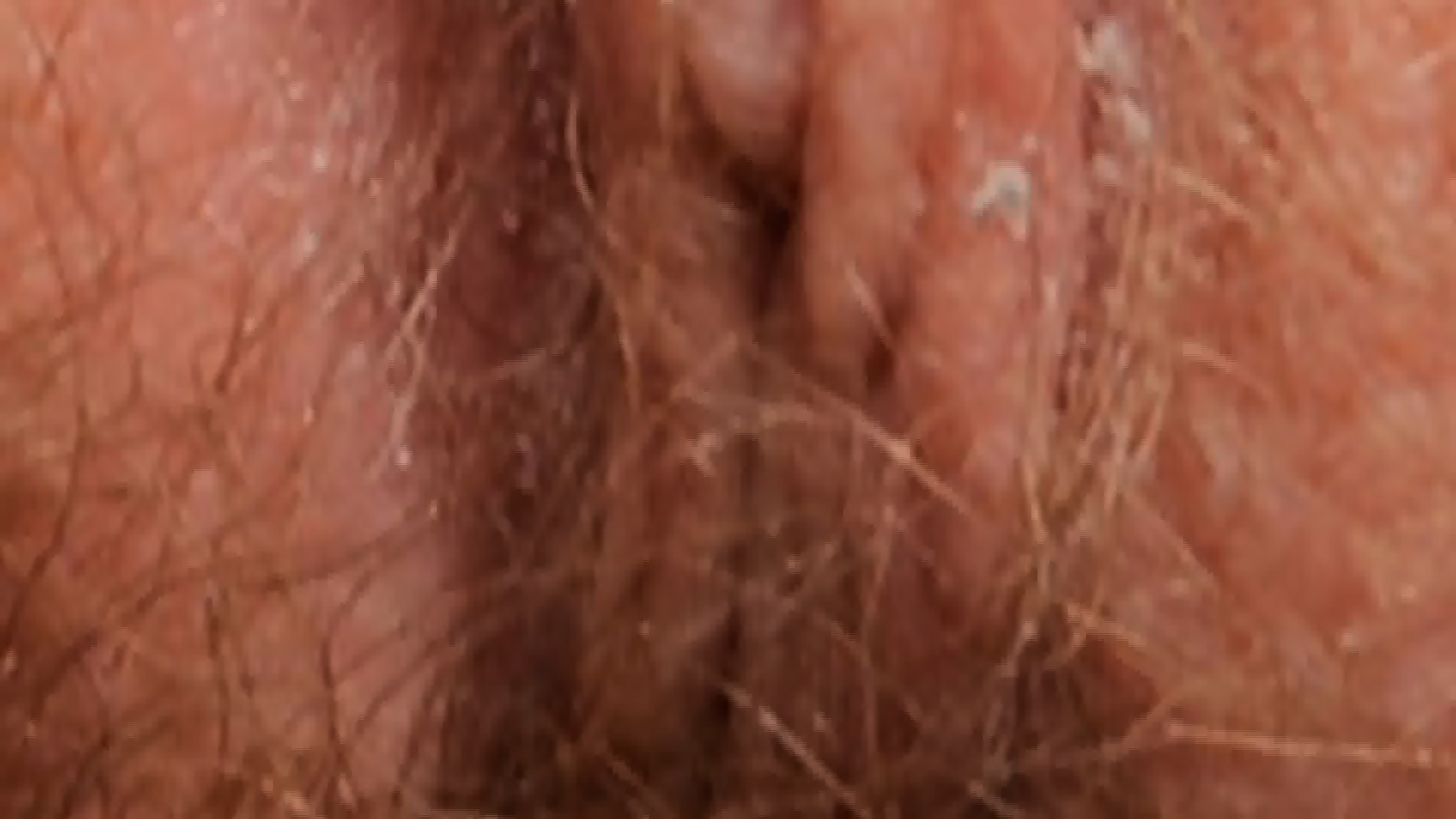 Female Textures Kiss Me Hd 1080pvagina Close Up Hairy Sex Pussy 